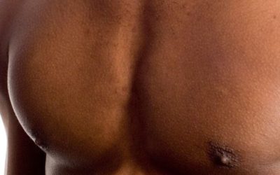 Depilación láser en el pecho femenino y masculino